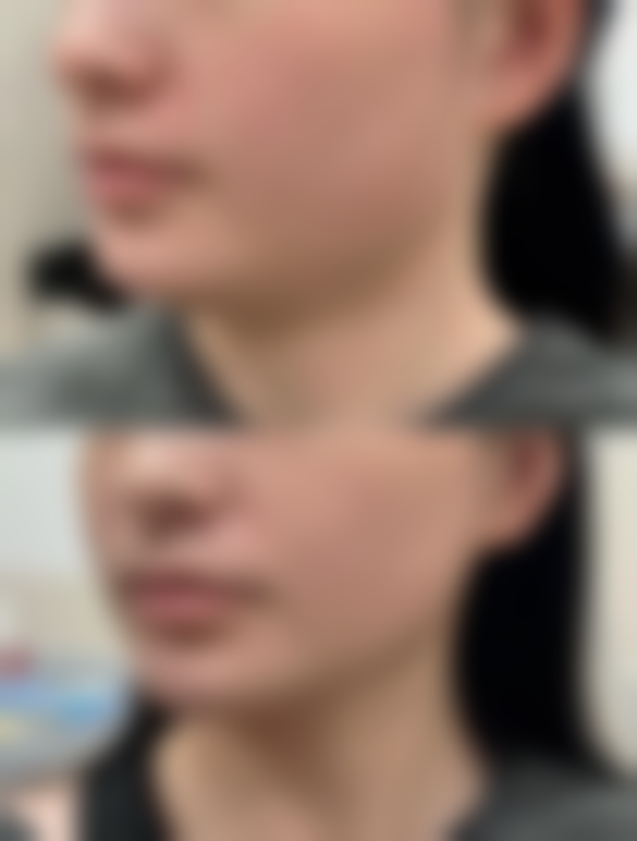 【金华玥莱美整形核心优势：】