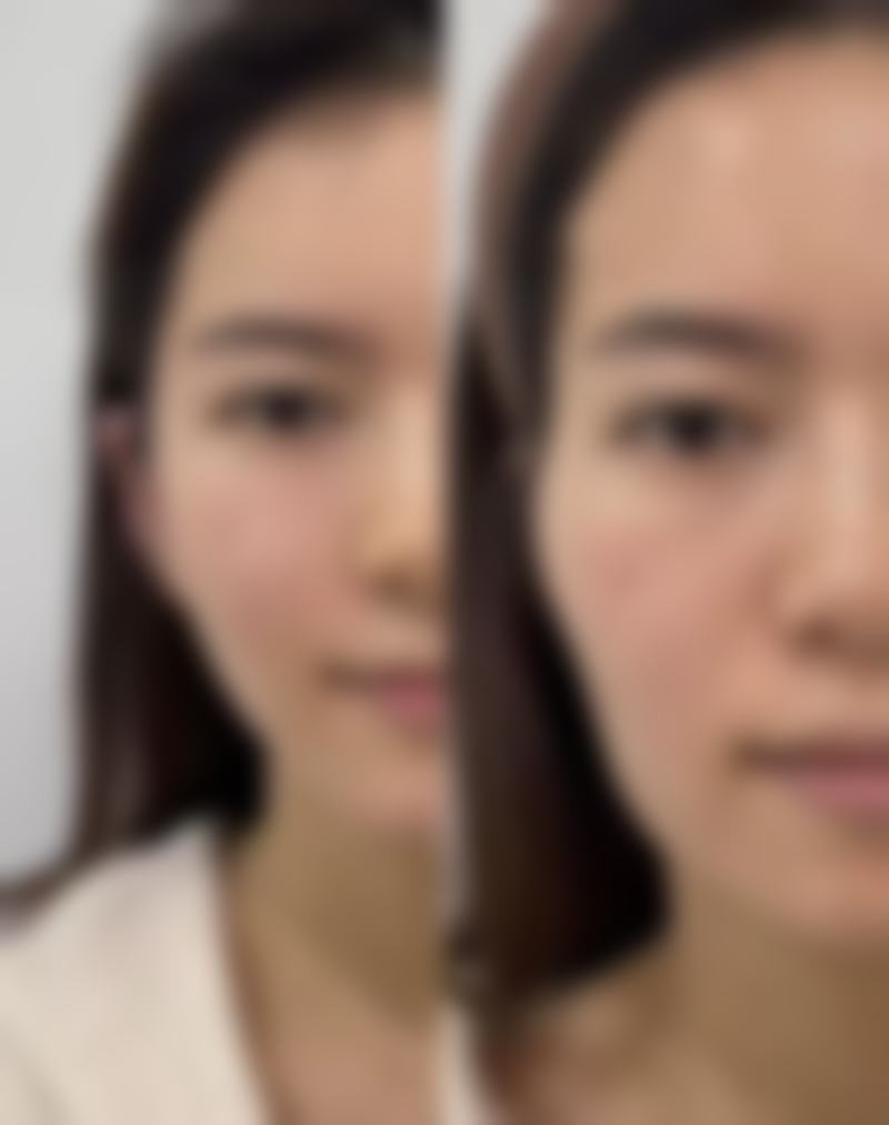 以下是一些患者对清远丽人整形美容医院的正向评价：