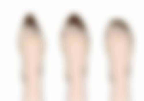 打完瘦脸针后嘴巴歪了