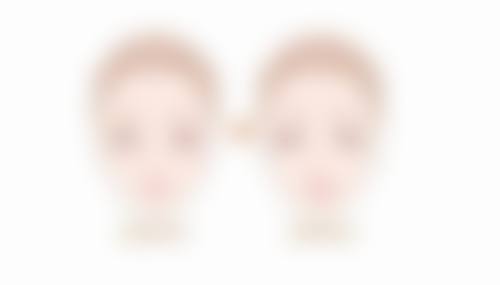 打瘦脸针有后遗症吗