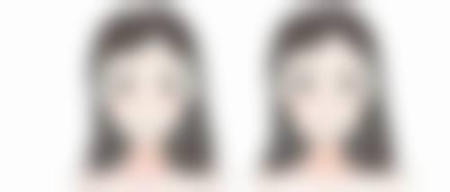 打完瘦脸针8天了感觉脸还是肿的