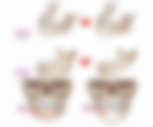 打完瘦脸多久有成效