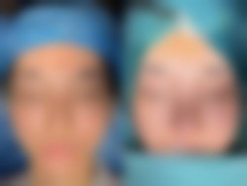 【郑晓华医生擅长项目】