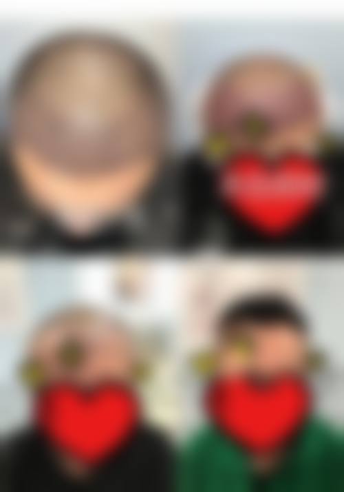 【韩国东大门美璞儿医院特色项目：】