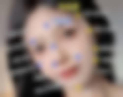 面部除皱针有副作用吗？了解这5大真相，让你放心变美，轻松告别皱纹困扰！ 