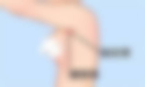 面部除皱针好的产品有哪些