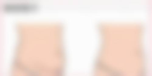 面部除皱针的打法