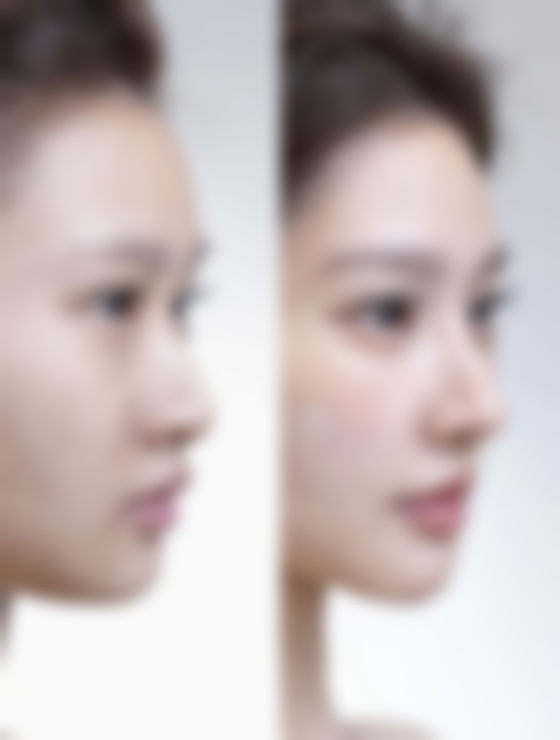 注射美白针有危害吗知乎