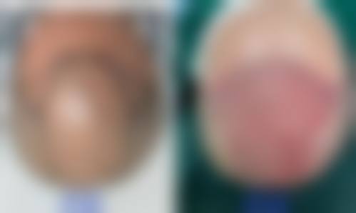 【上海佳富美医疗植发科患者口碑评价：】