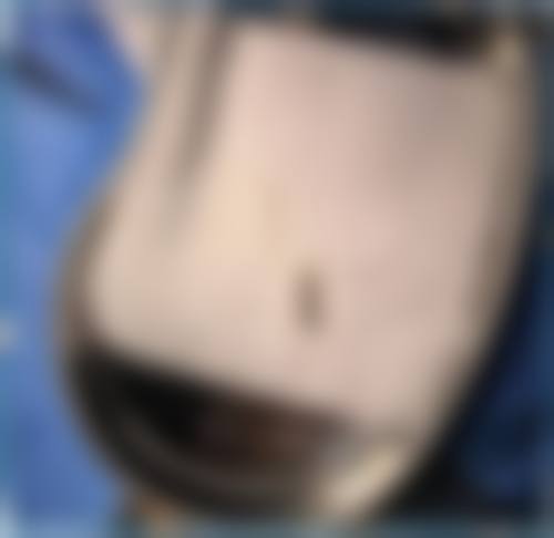 【张家口华妍医疗美容诊所核心优势：】