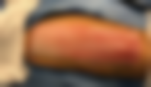 【张景石医生荣誉资质】