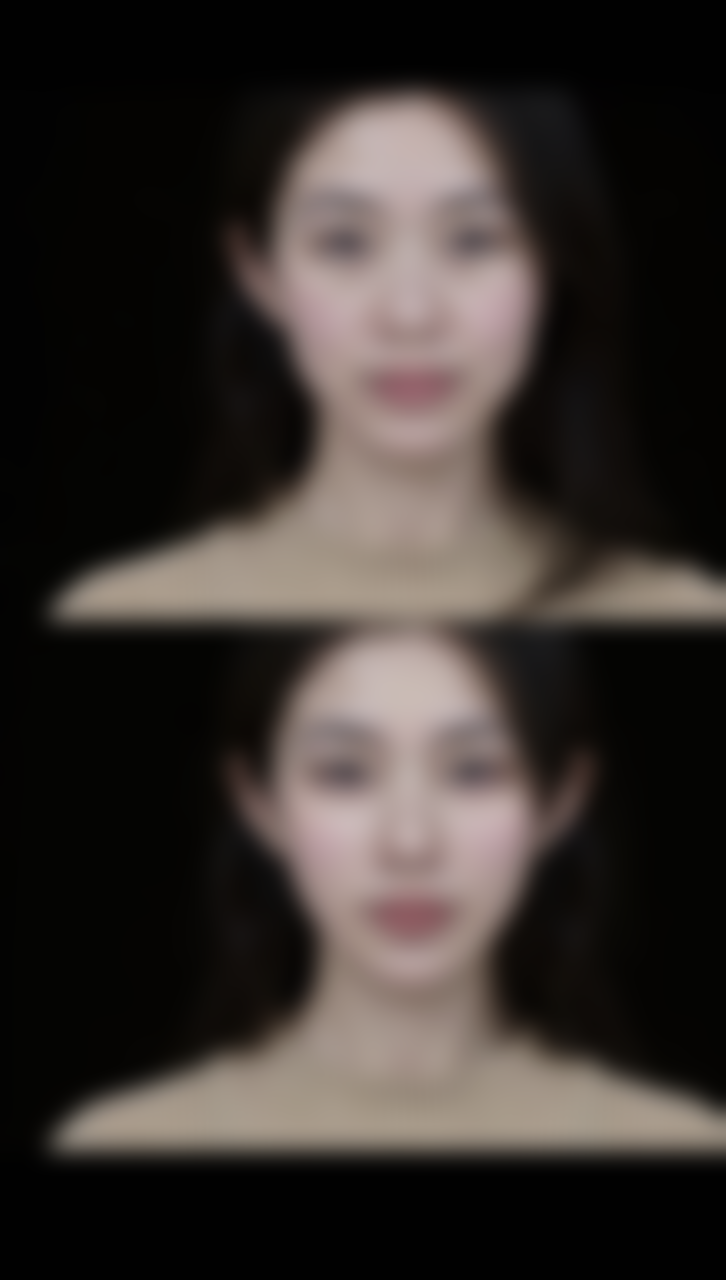 瘦脸针打完多久见效