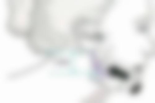 打完瘦脸针没感觉正常吗