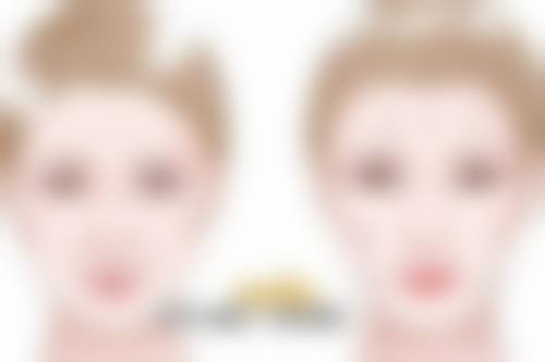 下颚骨折做手术大概需要多少钱