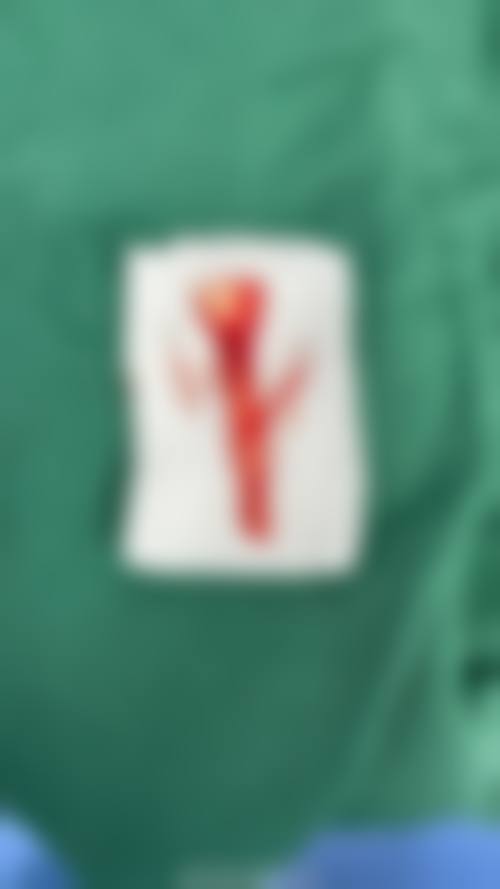 【杨洪洲医生口碑怎么样？】