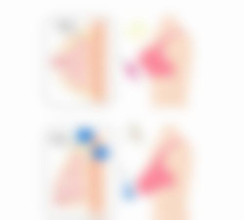 整容后悔了怎么办