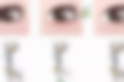 瘦脸针打一次维持多久