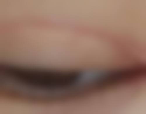 哪家医院打美白针好