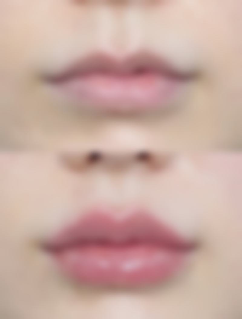 瘦脸针多少钱一次，要打几次定型