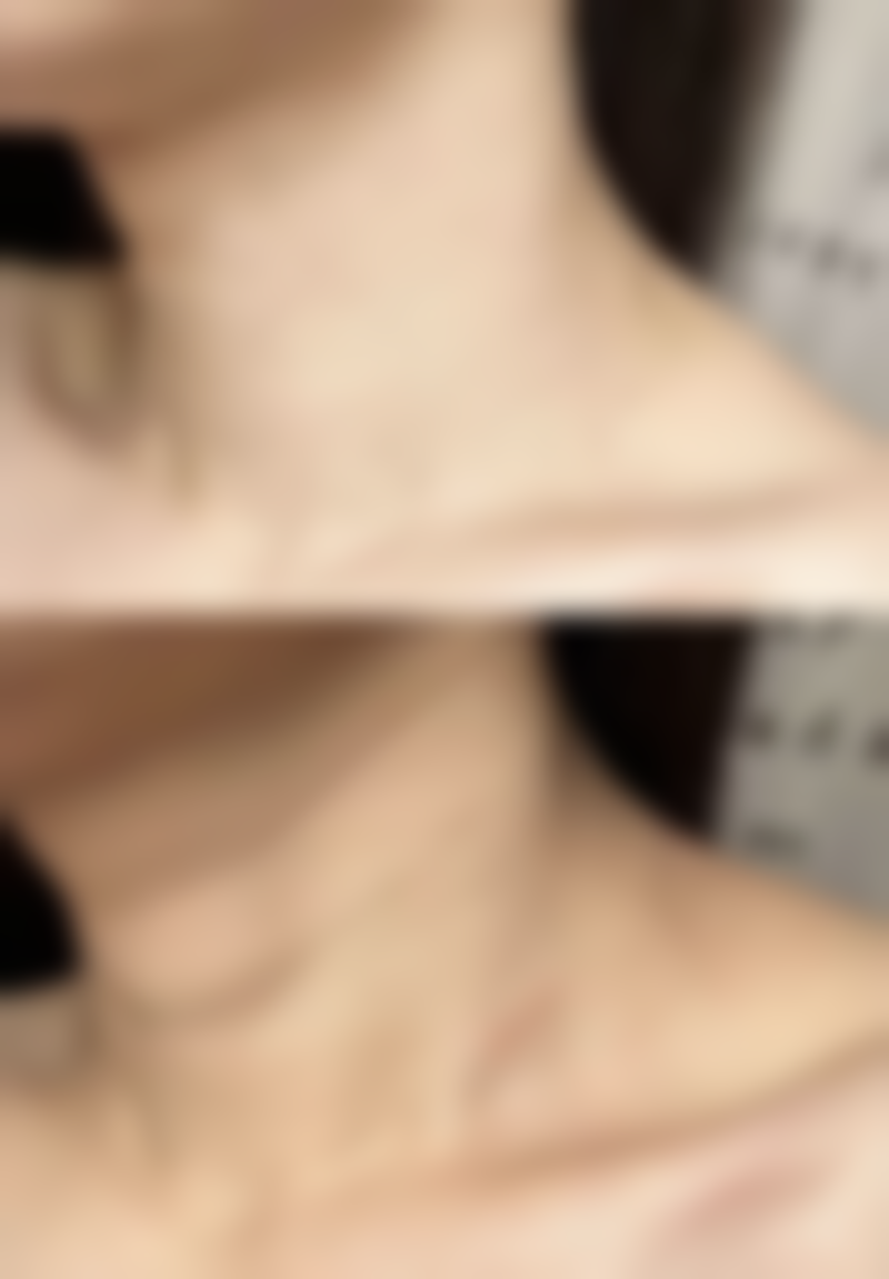 【新疆千禧丽人整形美容专科医院特色项目：】