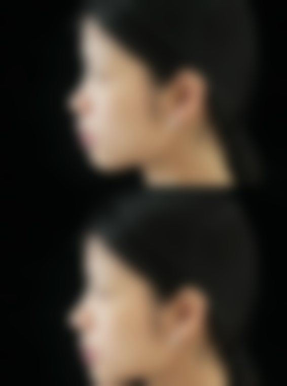 去哪里打美白针比较好