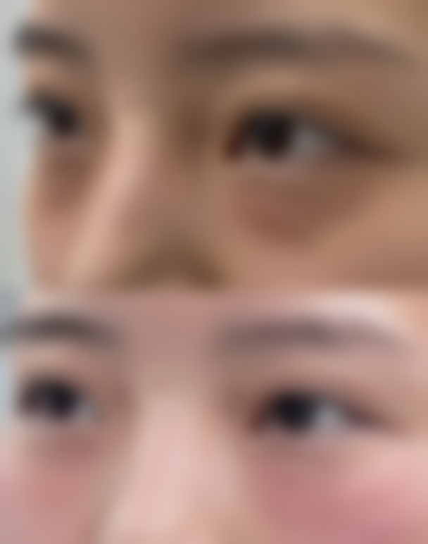 【鞠光植医生技术特点】