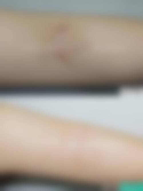 【邯郸复之色整形医疗美容门诊部是正规的吗?】