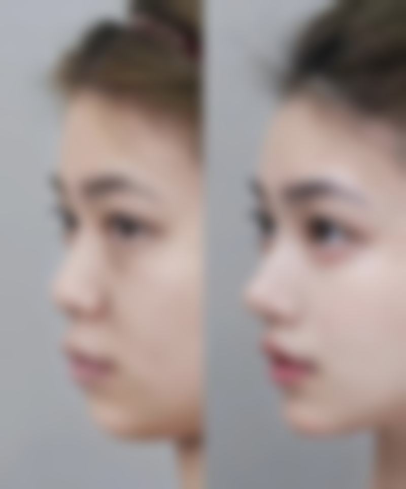 【深圳花漾美天医疗美容诊所特色项目：】