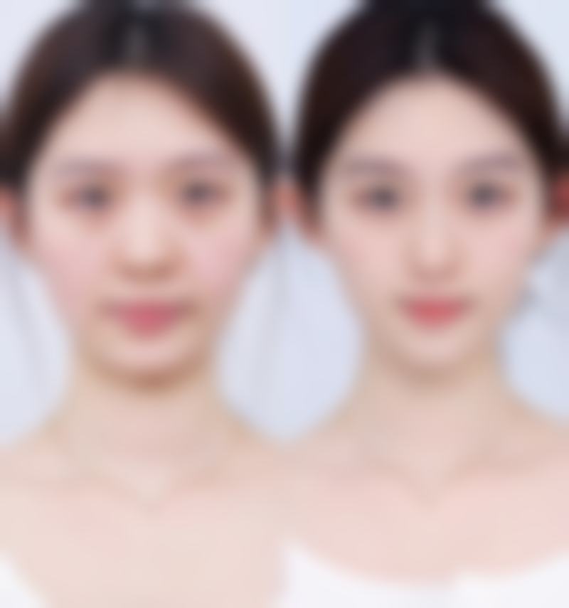 【呼伦贝尔董海杰医疗美容诊所参考价格表：】