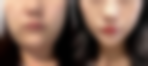 【深圳花漾美天医疗美容诊所参考价格表：】