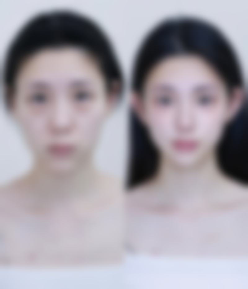 草莓怎么大面积种植呢