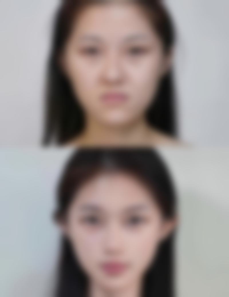 为什么草莓苗移栽要遵循深不埋心浅不露根的原则