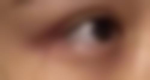 瘦脸针咬肌越大成效越好么？