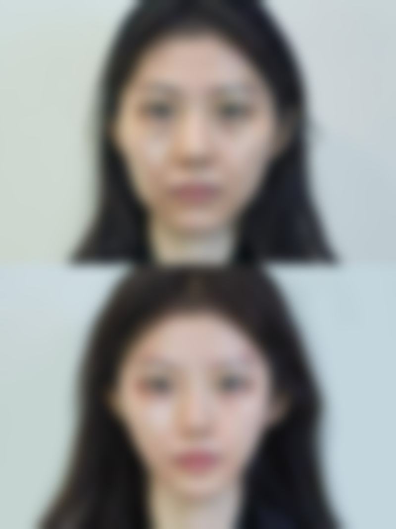 m唇手术哪家医院好