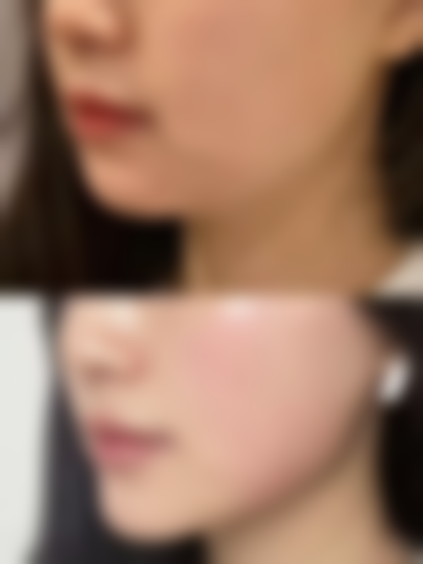 【朱仪谨医生口碑怎么样？】