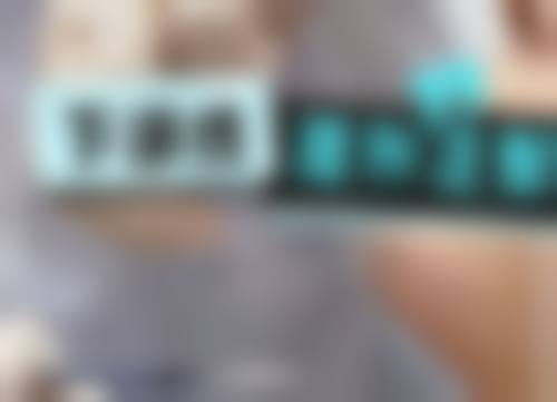 天生头发少可以植发好吗