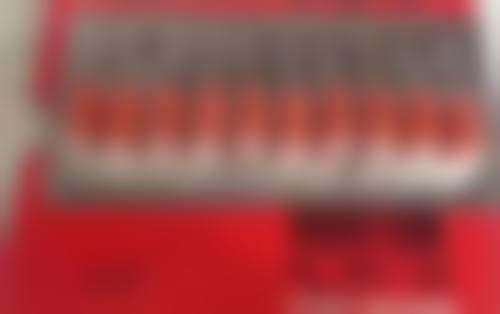 天生发量少可以植发吗