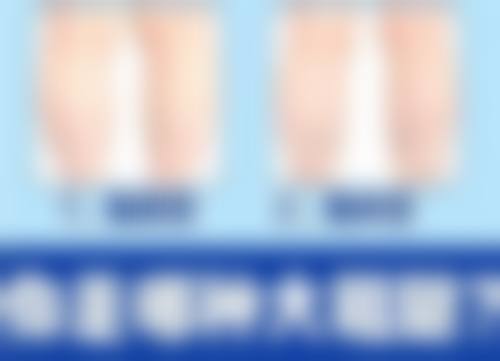 重庆铜雀台瘦脸针的优势