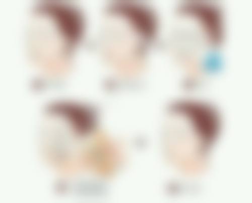 天生头发少可以生发吗