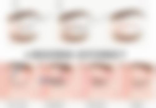 瘦脸针多久见效