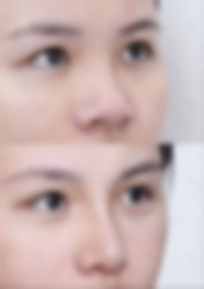 秦皇岛茗妃医疗美容诊所是正规的吗?