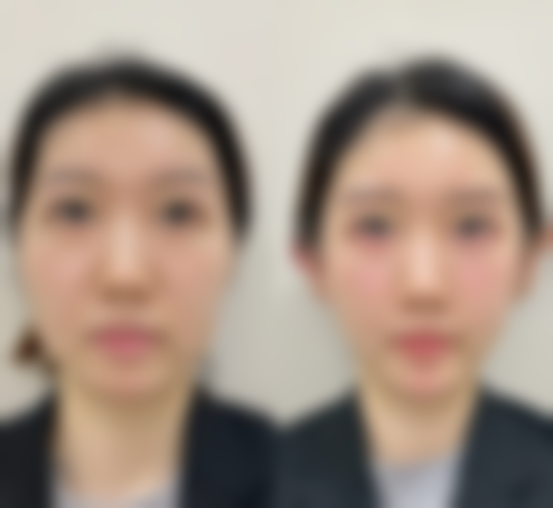 【罗然韩医院参考价格表：】