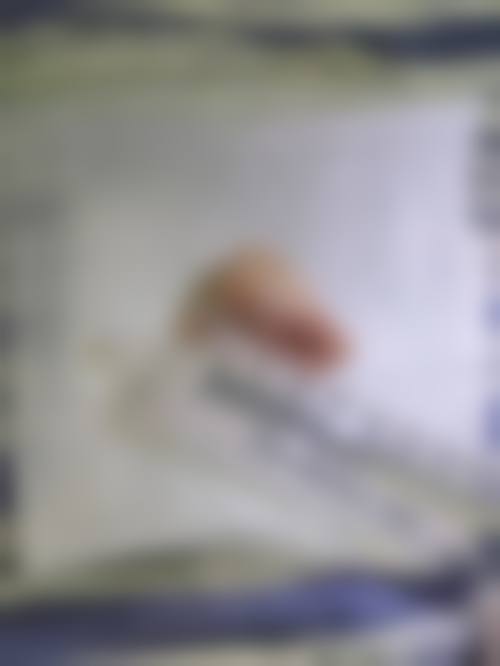 【石家庄晨美整形外科医院是正规的吗?】