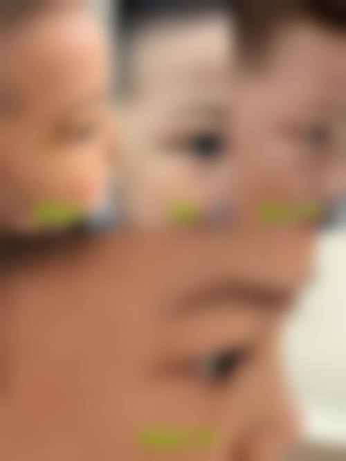 【邢台臻美整形医院患者口碑评价：】