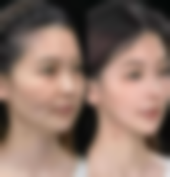 种植眉毛是永久吗？揭秘种植眉毛的持久性真相，3大优势让你拥有终身浓密美眉！ 