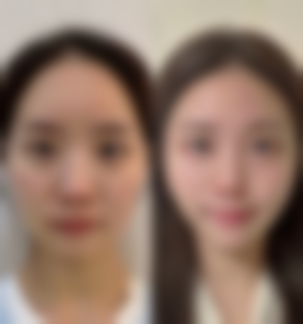 【杭州臻珠医疗美容诊所特色项目:】