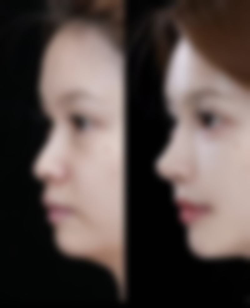 【山东佰瑞德美容医院特色项目：】