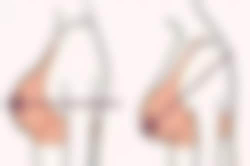 【韩国kcell皮肤科患者口碑评价：】