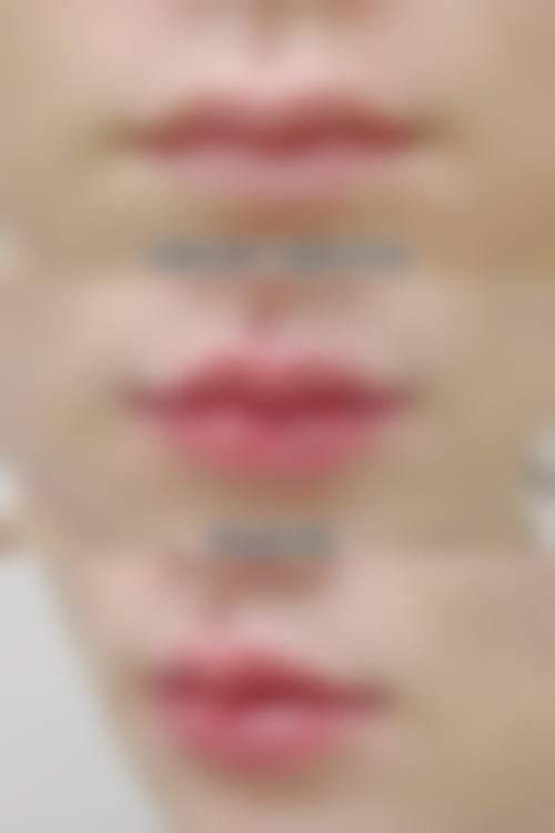 【密山玺妍整形医院地址：】