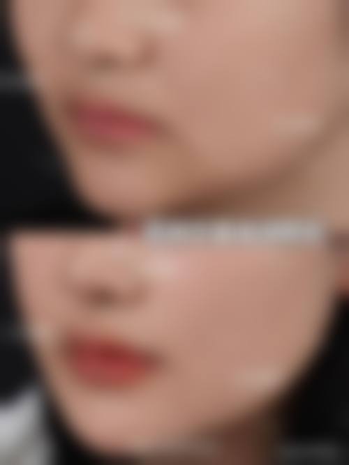 【郑州徐锐峰医疗美容诊所怎么预约挂号?】